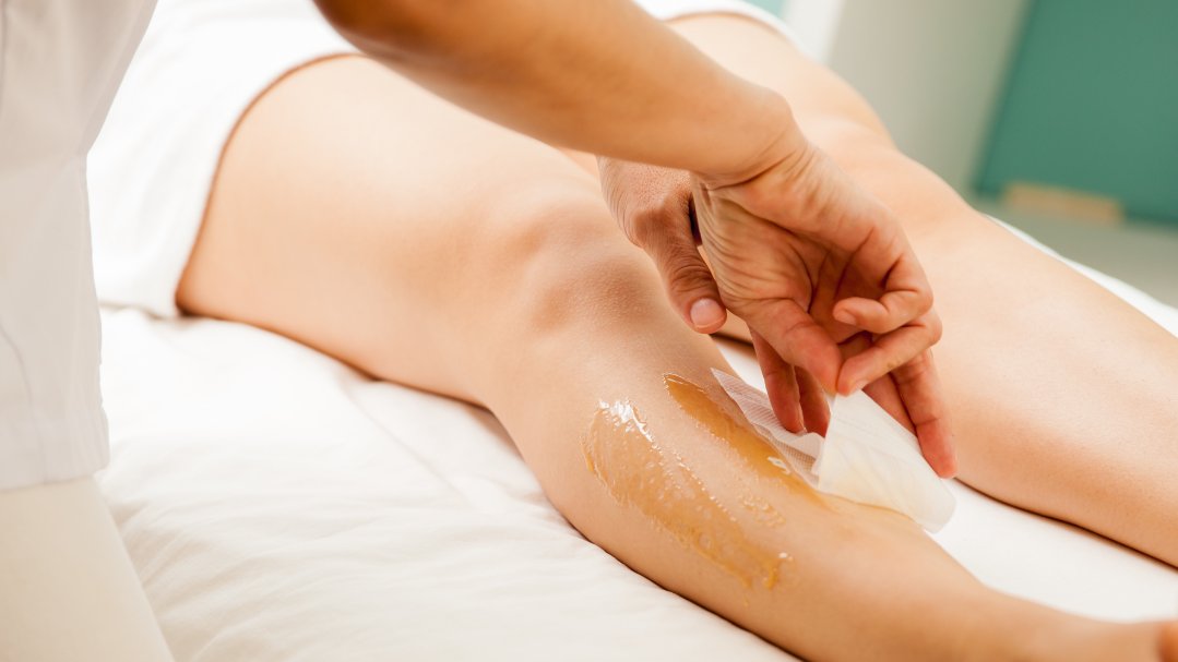 Depilación clásica - Foto 2