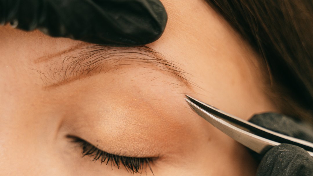 Depilación clásica - Foto 1