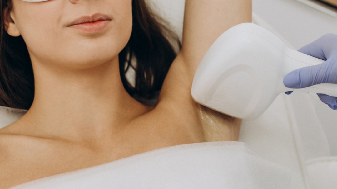 Depilación Láser Diodo - Foto 1