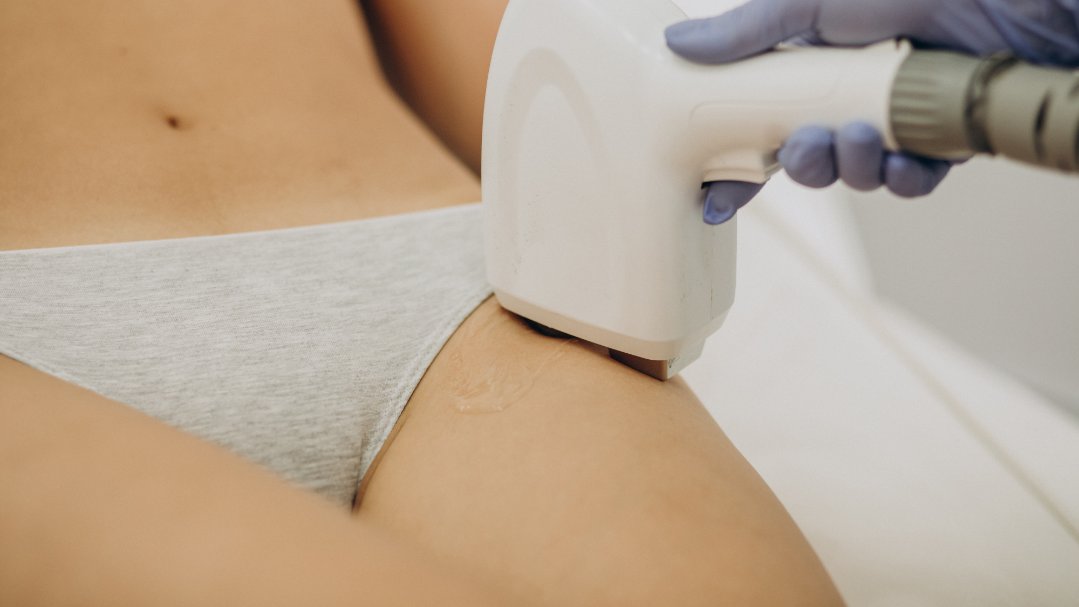 Depilación Láser Diodo - Foto 2